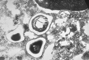 Nosema - brain, rabbit Nosema - brain, rabbit